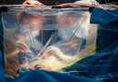 Realizaron una inédita cirugía cerebral con la paciente despierta